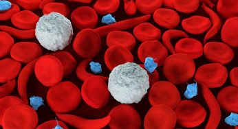 LASCC/HOPE FOUNDATIION—SICKLE CELL INITIATIVE